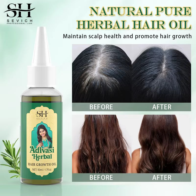 Ayurvedic Hair Growth Oil India Adivasi Organic Hair Growth Serum anti Hair Loss Fast Regrowth Thicken Oils Hair Growth Products